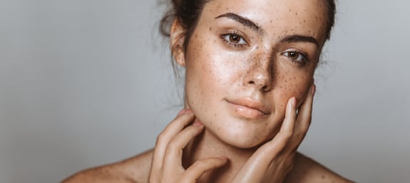 Skin Discolouration